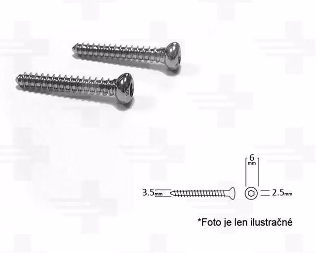 b9531ed14f64af83fd947c8fab369e57